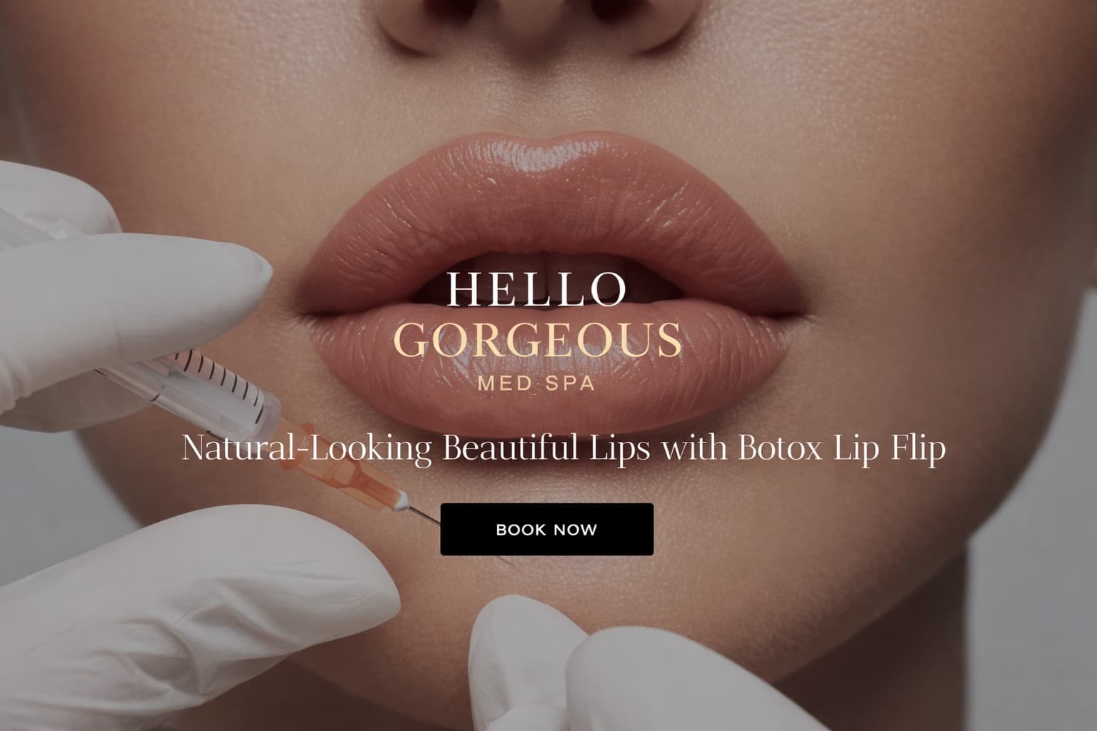 Natural-looking beautiful lips with Botox Lip Flip at Hello Gorgeous Med Spa