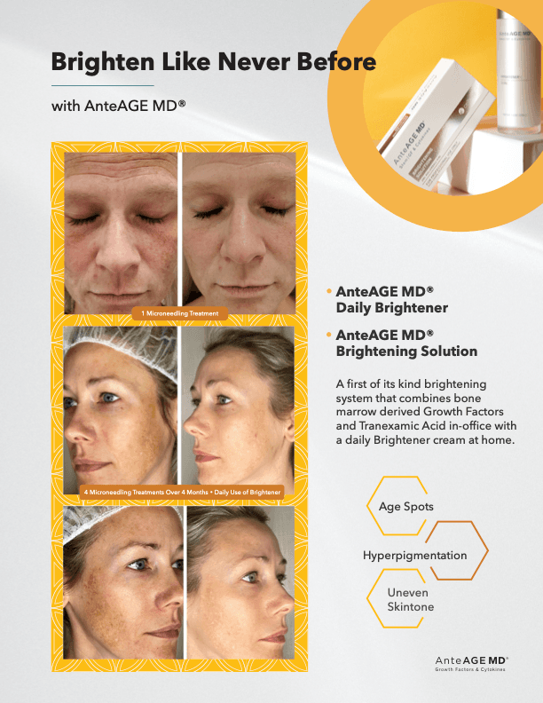 AnteAGE regenerative skincare at Hello Gorgeous Med Spa Oswego IL