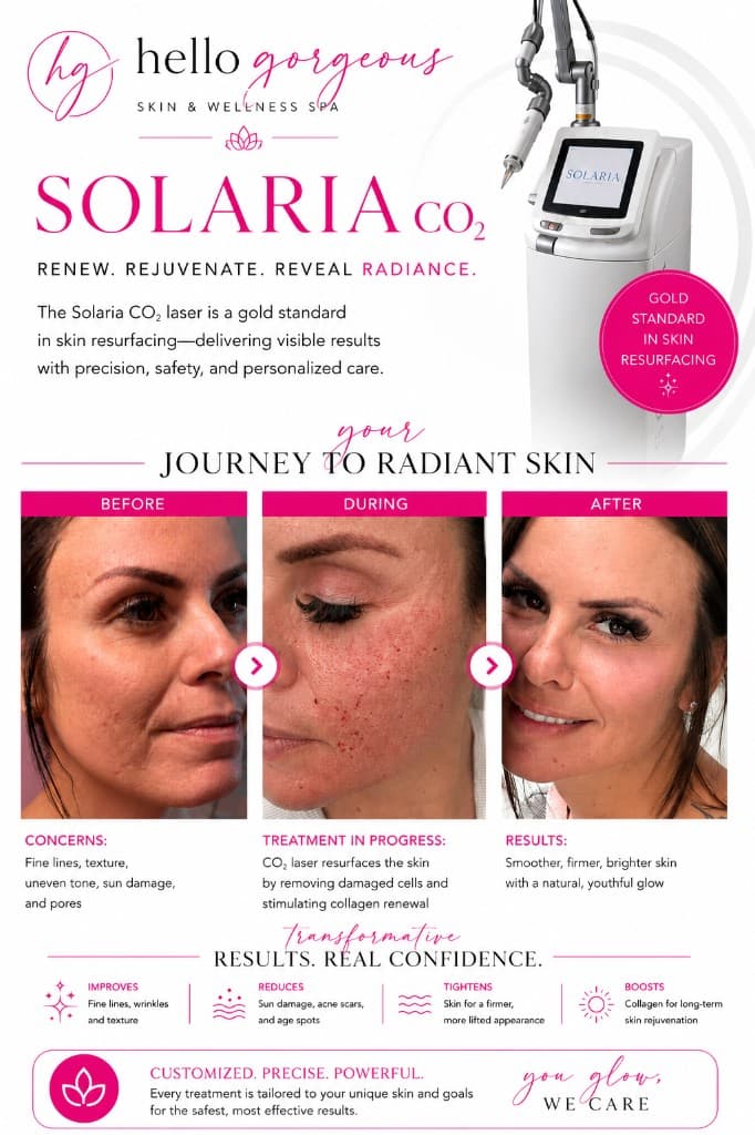 Solaria CO2 laser before, during, and after skin resurfacing at Hello Gorgeous Med Spa Oswego — gold standard fractional CO2
