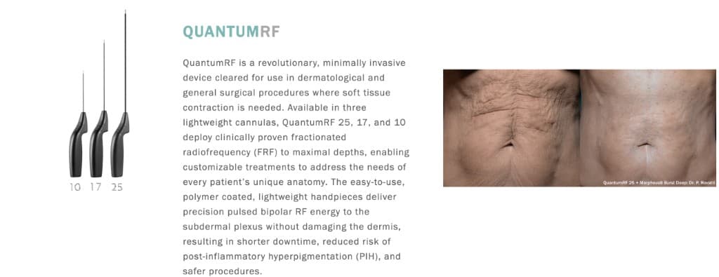 InMode Quantum RF handpieces used for face and body contour