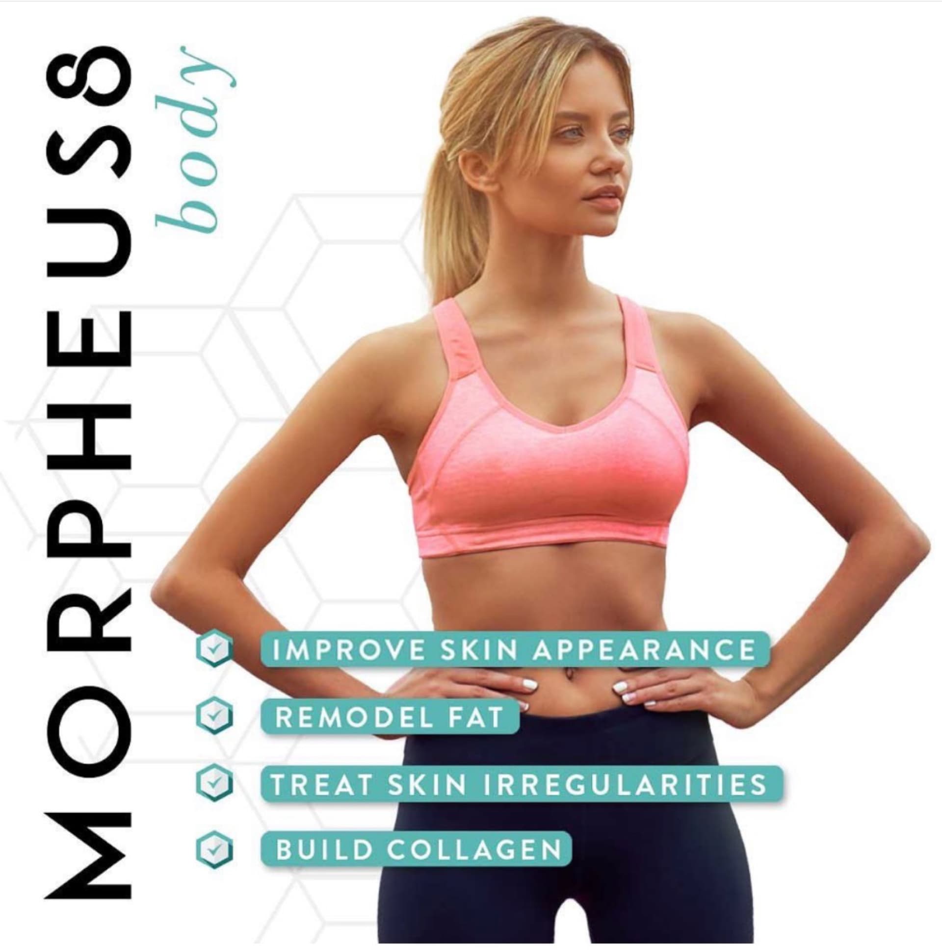 Morpheus8 Body — improve skin, remodel fat, build collagen